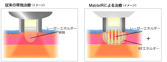リファームのイメージ