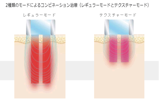 リファームのイメージ