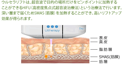 Q-XCb`r[[U[Ǝ˃C[W