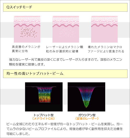 Q-XCb`r[[U[Ǝ˃C[W